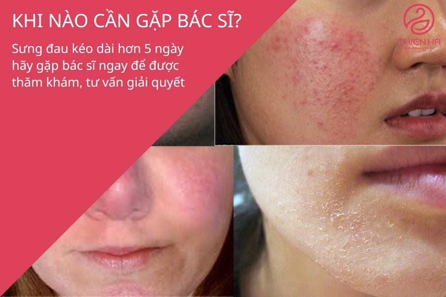 Khi nào cần gặp bác sĩ