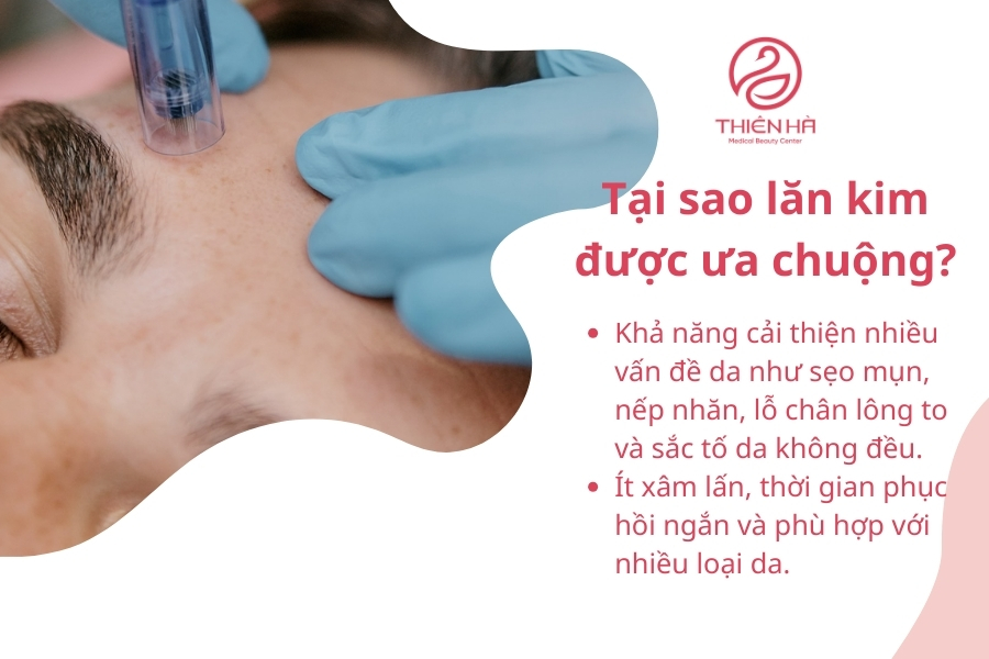 Lăn kim là gì và tại sao nó được ưa chuộng