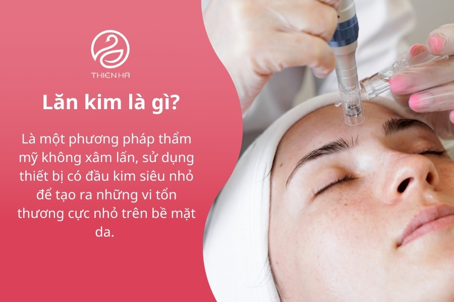 Kim lăn được cấu tạo từ nhiều đầu kim nhỏ, giúp tạo ra các vi tổn thương trên da, kích thích sản sinh collagen và elastin một cách tự nhiên.