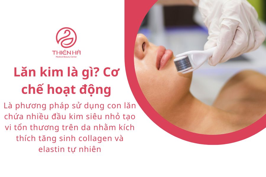 Lăn kim là gì? Tác dụng, quy trình và lưu ý quan trọng 1 Lăn kim là gì? Cơ chế hoạt động của lăn kim