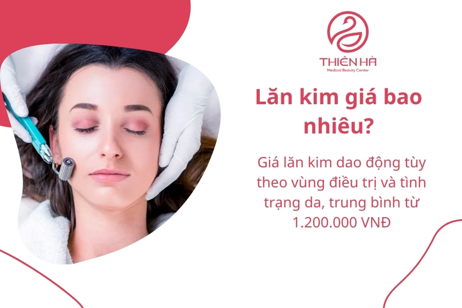 Lăn kim giá bao nhiêu?