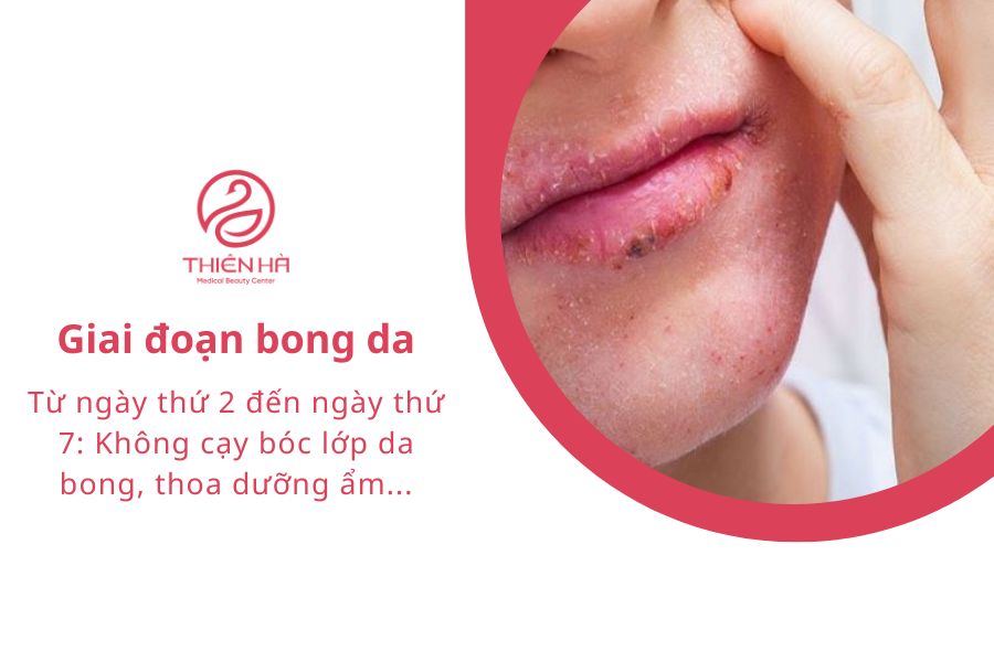 Lăn kim mấy ngày bong da? Quy trình & lưu ý 4 Giai đoạn bong da: Từ ngày thứ 2 đến ngày thứ 7