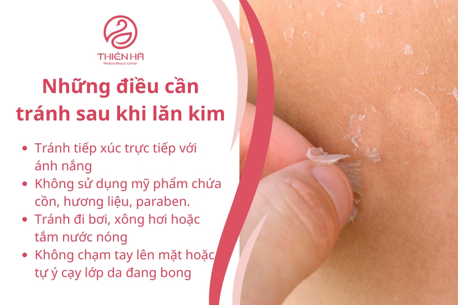 Những điều cần tránh sau khi lăn kim