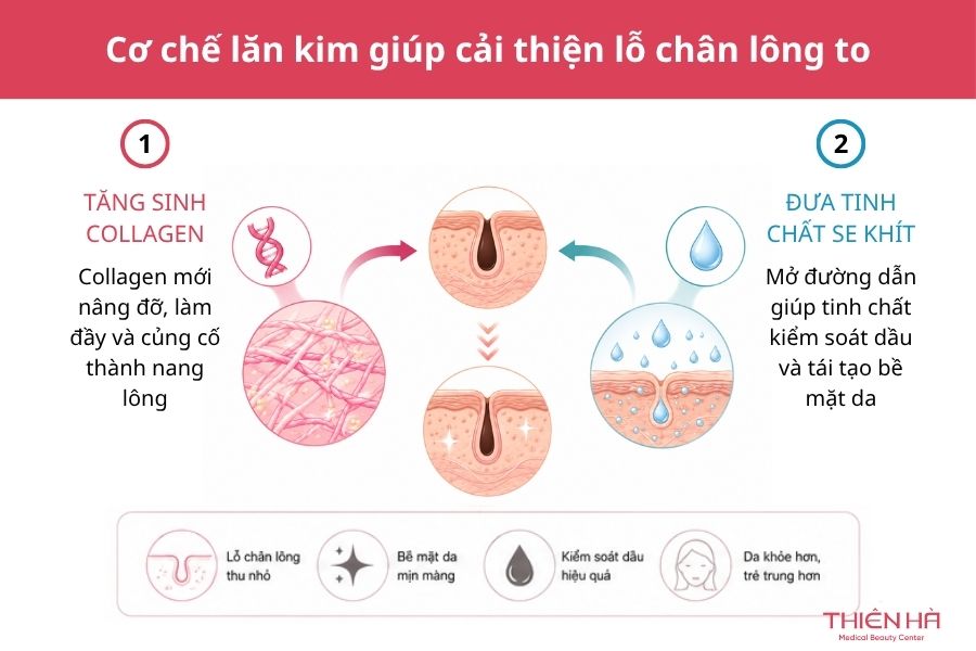 Lăn kim trị lỗ chân lông to: Hiệu quả thực tế và tư vấn từ Bác sĩ 1 Cơ chế lăn kim giúp cải thiện lỗ chân lông to