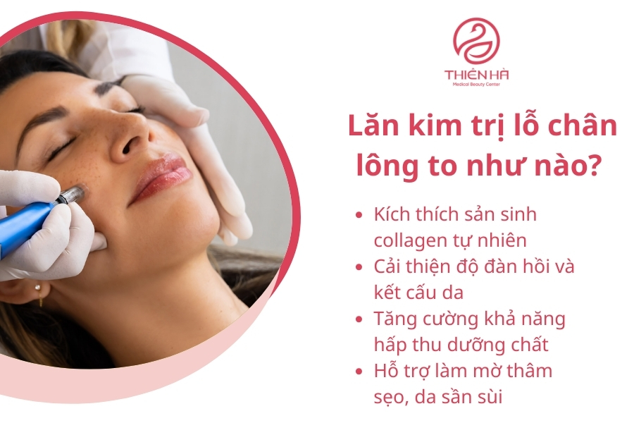  Lăn kim trị lỗ chân lông to như nào
