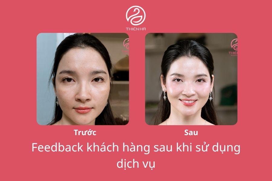 Lăn kim trị lỗ chân lông to: Hiệu quả thực tế và tư vấn từ Bác sĩ 2 Hiệu quả thực tế khi lăn kim trị lỗ chân lông to