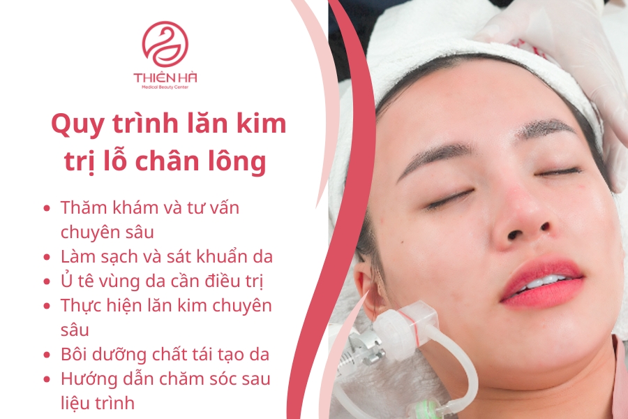 Quy trình lăn kim trị lỗ chân lông to tại Viện thẩm mỹ Thiên Hà