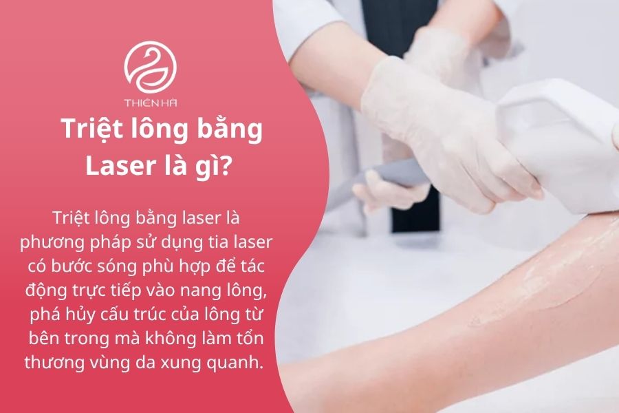Triệt lông sử dụng laser