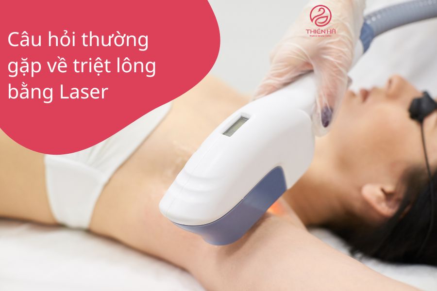 Câu hỏi thường gặp
