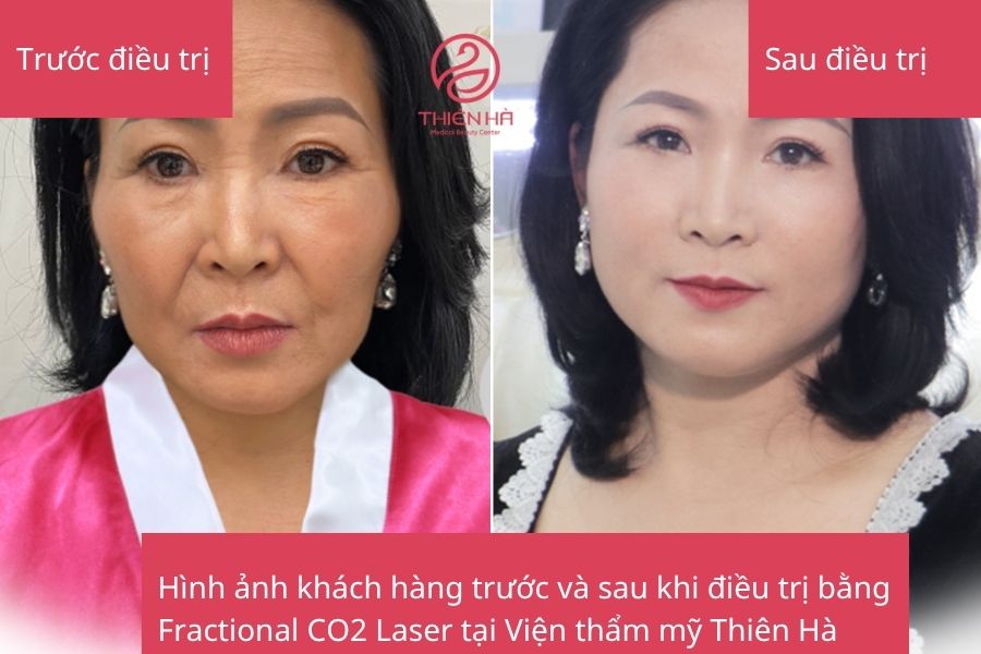 Hình ảnh thực tế khách hàng trước và sau điều trị