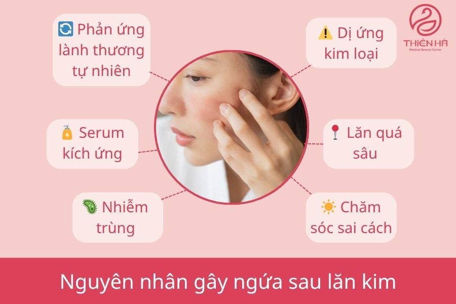Ngứa sau lăn kim: Nguyên nhân và cách khắc phục hiệu quả 1 Ngứa nhẹ sau lăn kim là phản ứng bình thường của cơ thể