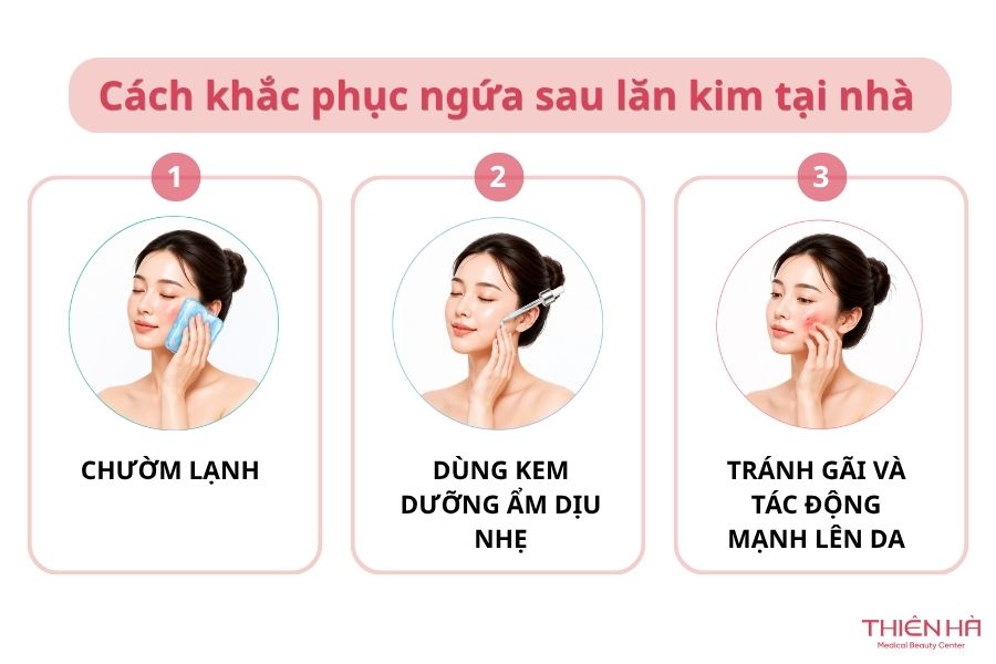 Ngứa sau lăn kim: Nguyên nhân và cách khắc phục hiệu quả 2 Các cách khắc phục ngứa sau lăn kim tại nhà hiệu quả