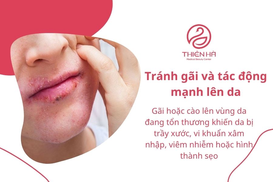 Ngứa sau lăn kim: Nguyên nhân và cách khắc phục hiệu quả 4 Gãi có thể gây tổn thương và nhiễm trùng da, đặc biệt trong giai đoạn da đang phục hồi sau lăn kim