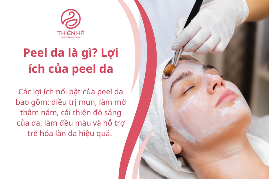 Peel da là gì? Lợi ích của peel da