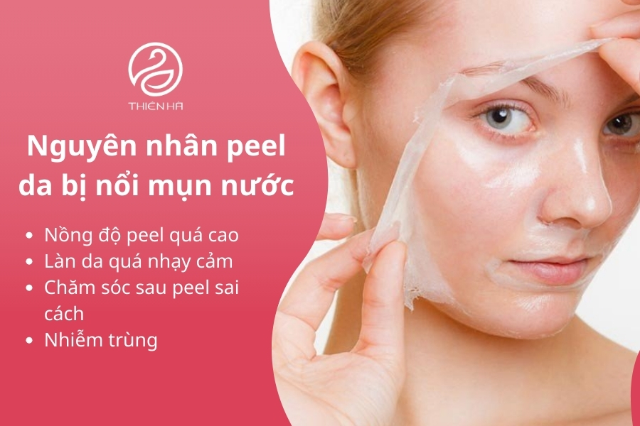 Nguyên nhân peel da bị nổi mụn nước