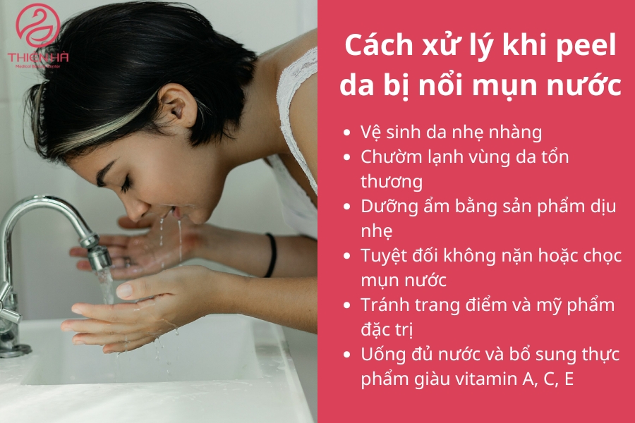  Cách xử lý khi peel da bị nổi mụn nước tại nhà