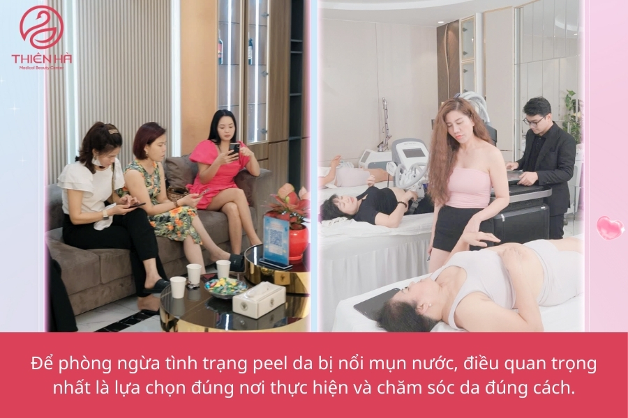 Phòng ngừa peel da bị nổi mụn nước