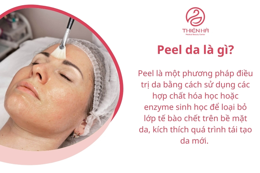  Peel da là gì