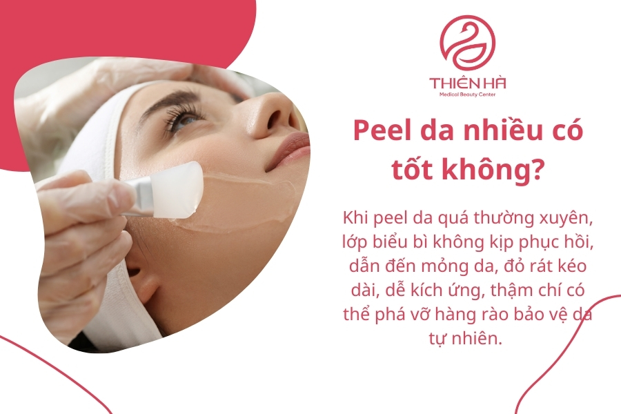  Peel da nhiều có tốt không? Tần suất peel da an toàn