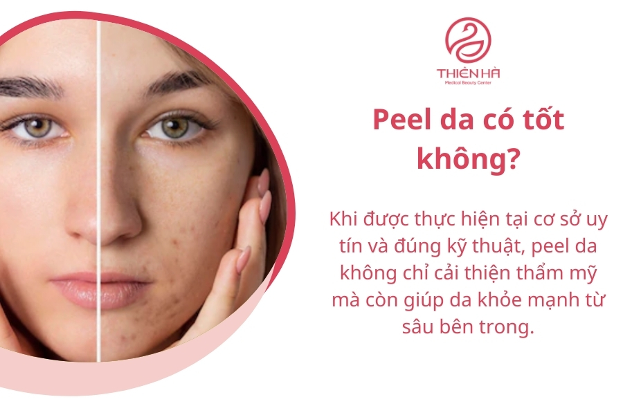 Peel da có tốt không