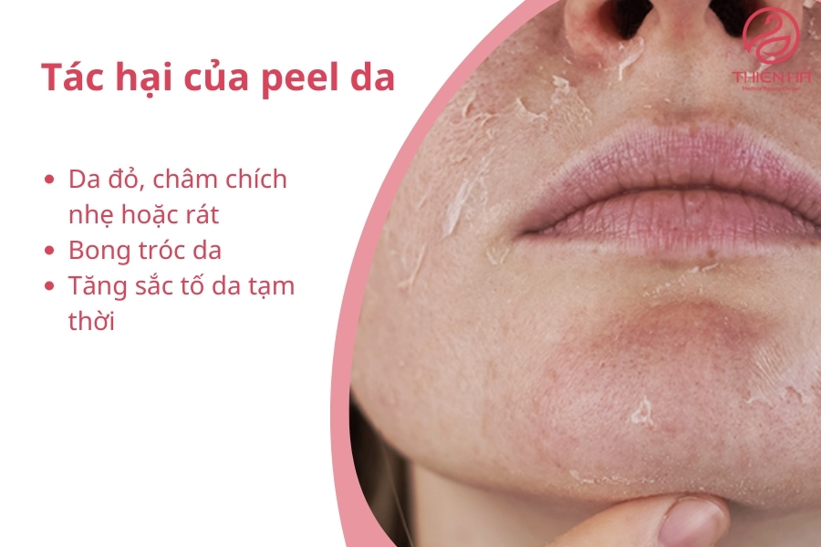 Tác hại của peel da và những điều cần lưu ý