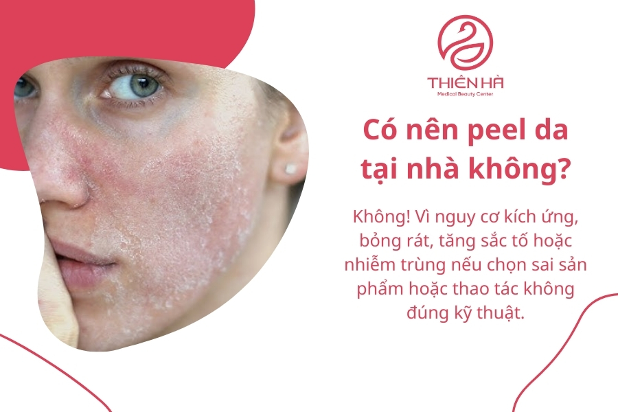 Có nên peel da tại nhà không?