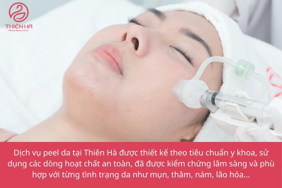  Peel da tại Thẩm mỹ viện Thiên Hà