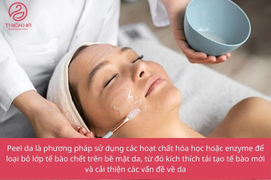 Peel da là gì? Các loại peel da phổ biến