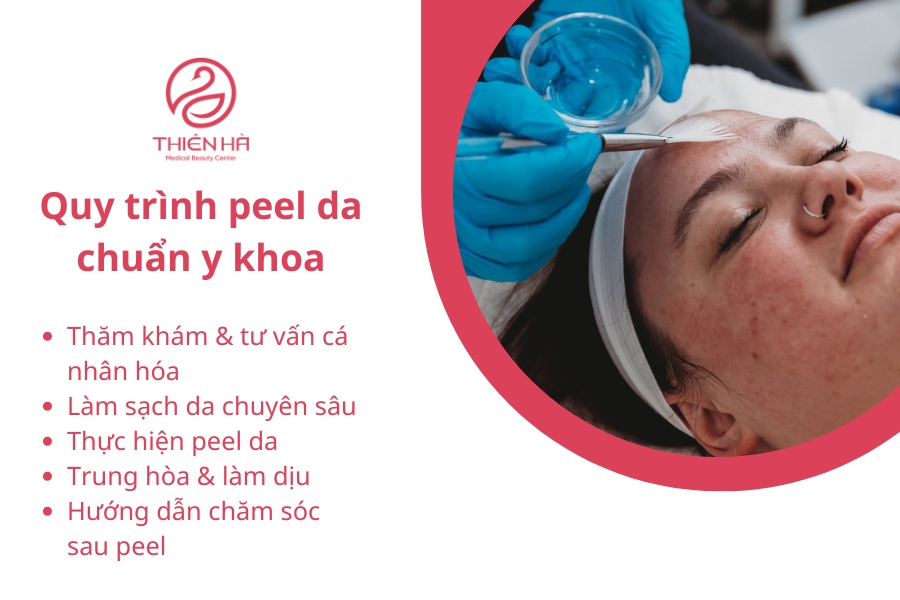  Quy trình peel da chuẩn y khoa tại Viện thẩm mỹ Thiên Hà