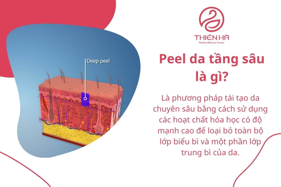 Peel da tầng sâu là gì