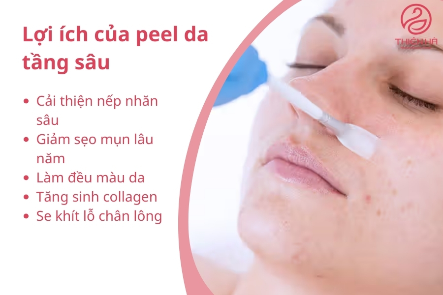 Peel da tầng sâu là gì