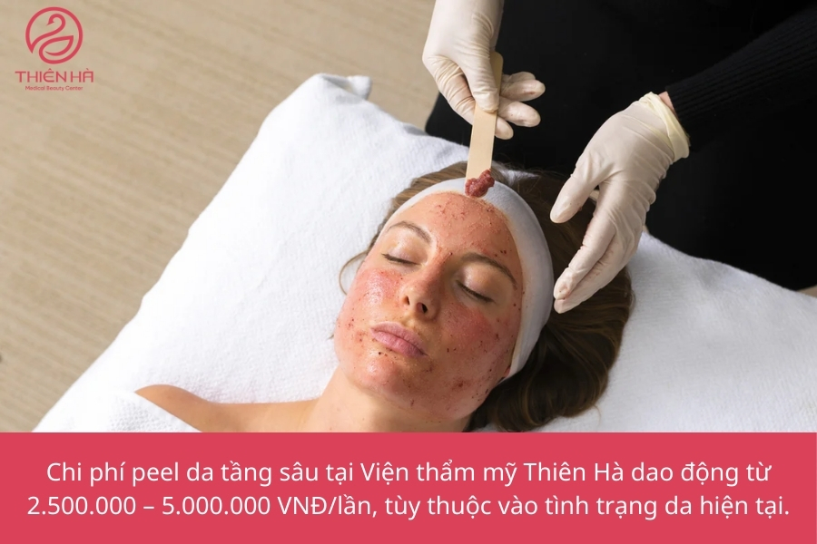 Chi phí peel da tầng sâu tại Viện thẩm mỹ Thiên Hà