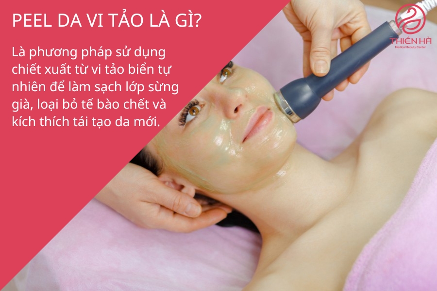  Peel da vi tảo là gì