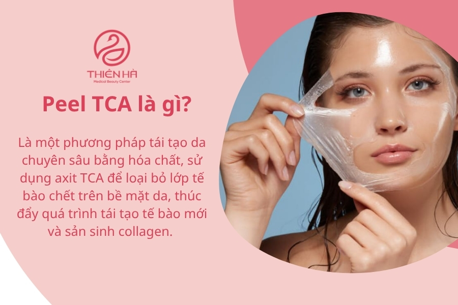 Peel TCA là gì