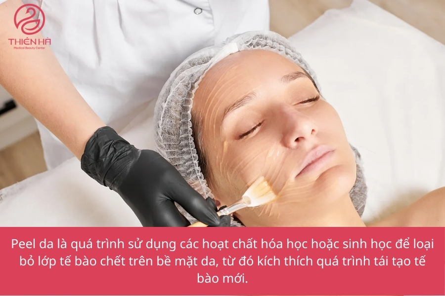 Peel Da Là Gì? Các Loại Peel Da Phổ Biến