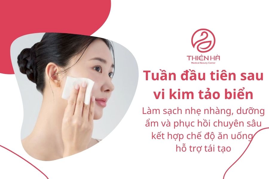 Sau khi vi kim tảo biển nên làm gì? Chăm sóc da đúng cách 3 Cách chăm sóc da trong tuần đầu tiên sau vi kim tảo biển
