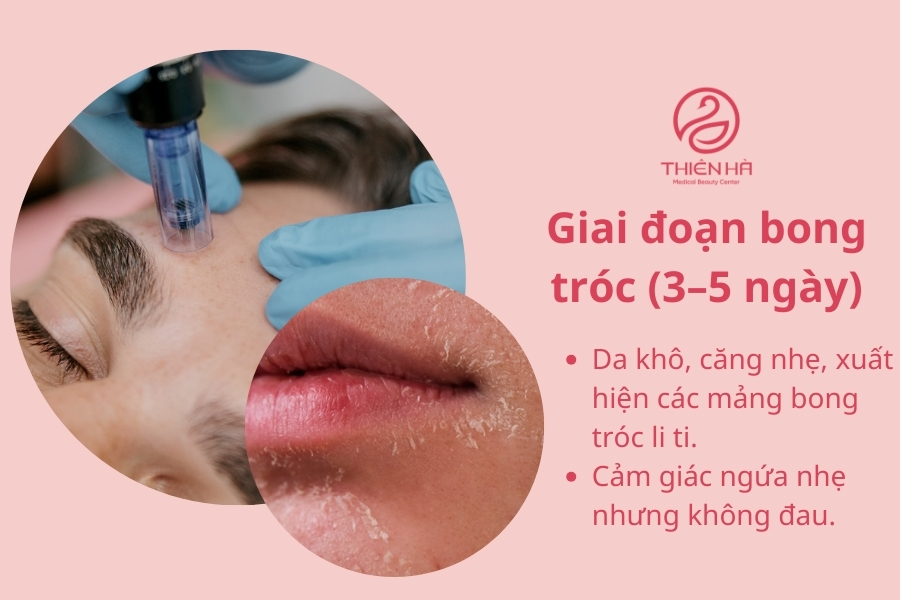 Bong tróc nhẹ là dấu hiệu da đang tái tạo