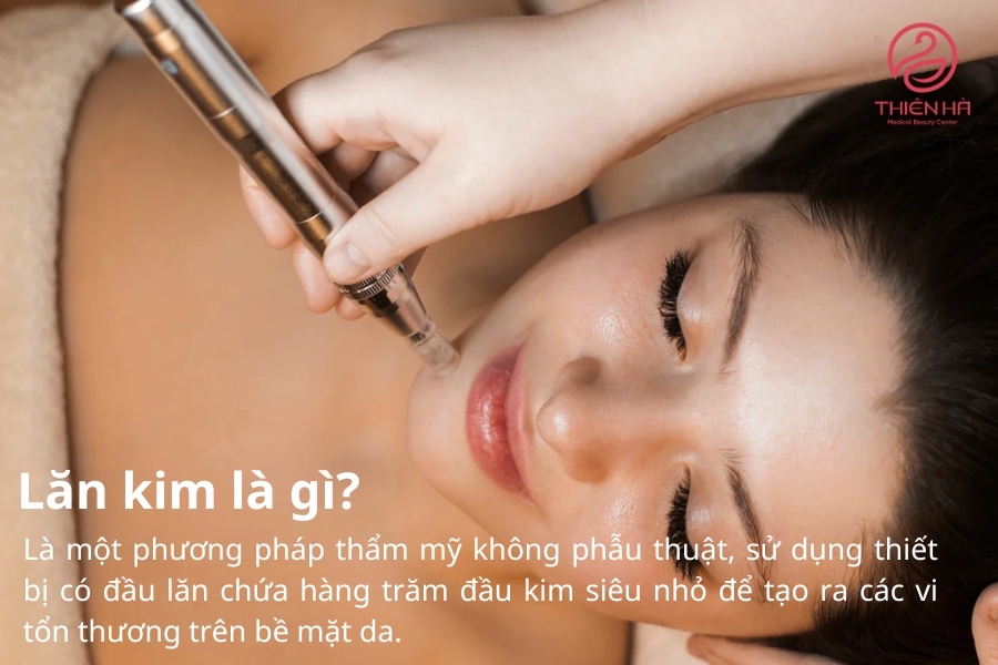 Kim lăn có nhiều kích thước khác nhau tùy thuộc vào mục đích sử dụng như điều trị sẹo, làm sáng da hay cải thiện lỗ chân lông.