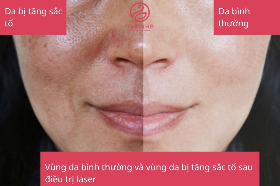 Thay đổi sắc tố da