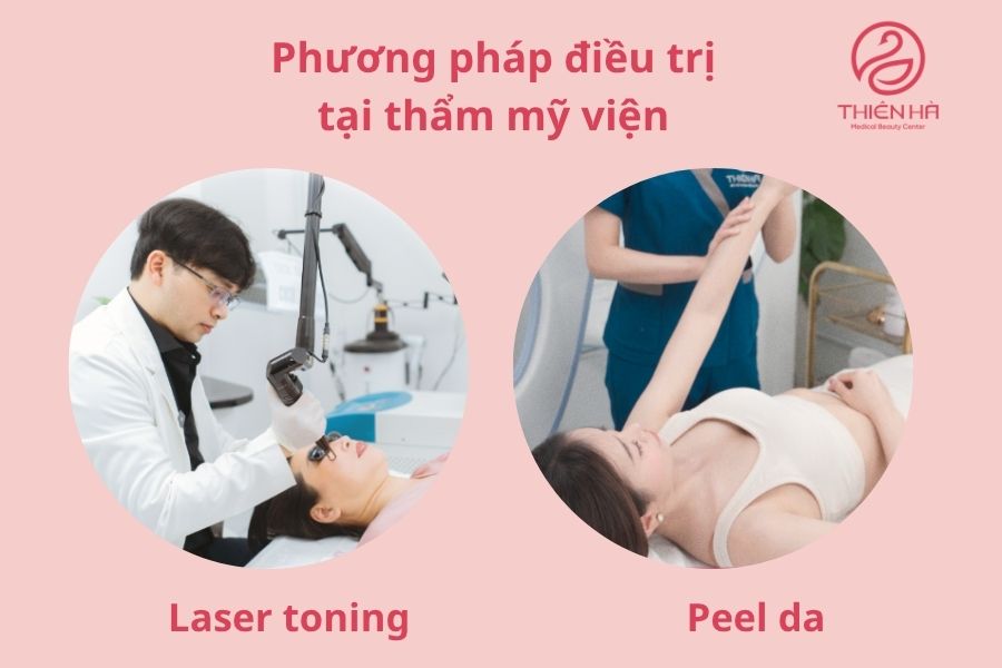 Phương pháp điều trị tại thẩm mỹ viện