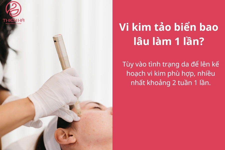 Vi kim tảo biển bao lâu làm 1 lần?