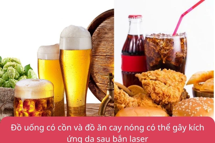 Đồ uống có cồn và đồ ăn cay nóng có thể gây kích ứng da sau bắn laser
