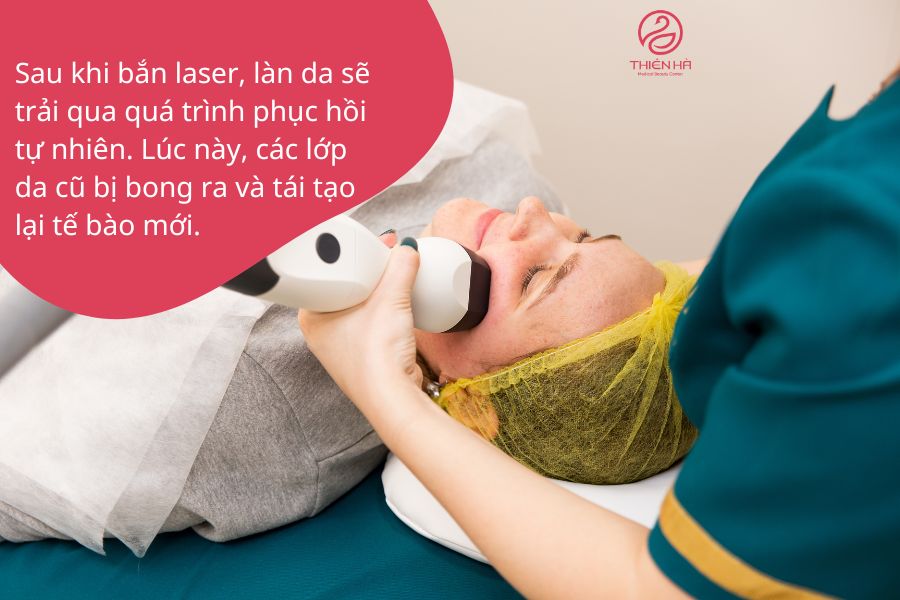 Nguyên tắc chung về chế độ ăn uống sau bắn laser