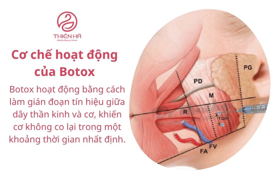 Cách Botox tác động lên cơ mặt