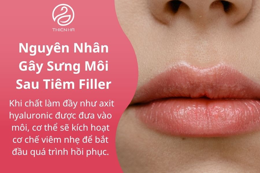 Nguyên Nhân Gây Sưng Môi Sau Tiêm Filler