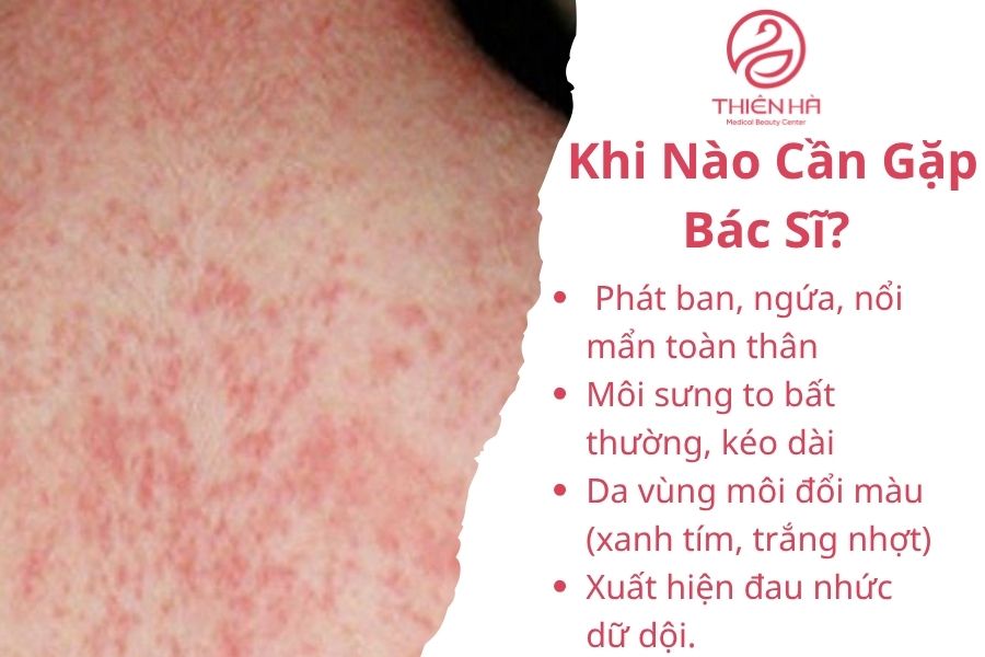 Phát ban, ngứa, nổi mẩn toàn thân