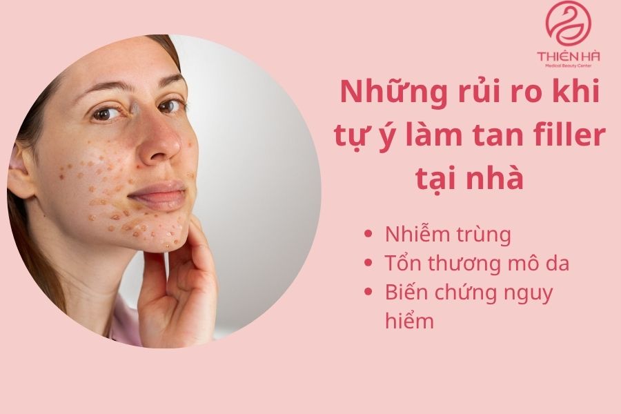 Biến chứng nguy hiểm khi tự ý làm tan filler.