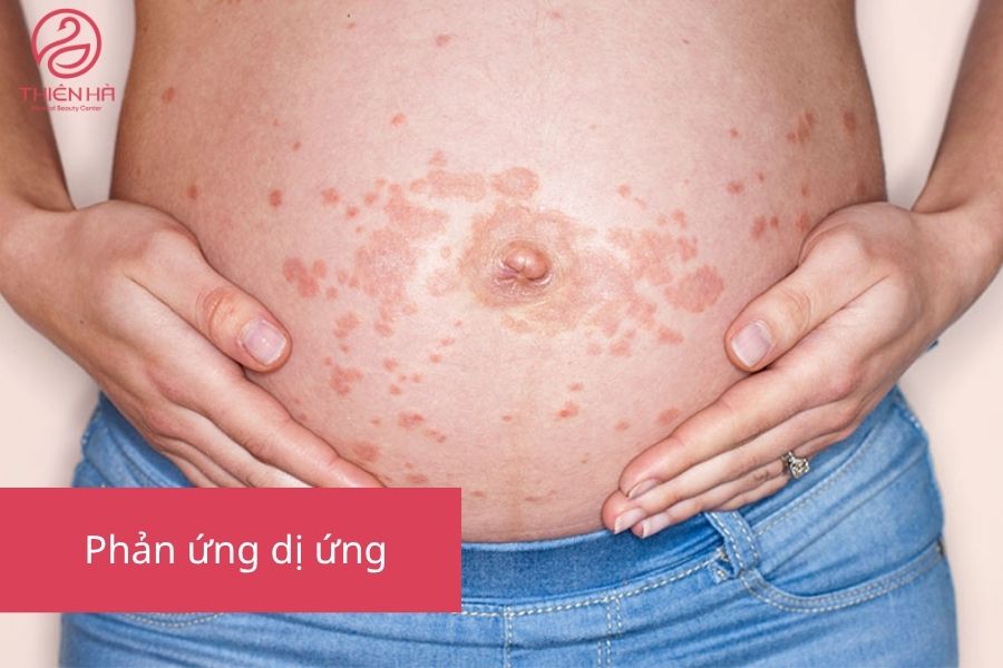  Rủi ro tiềm ẩn khi tiêm filler cho bà bầu