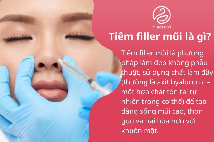 Tiêm filler mũi là gì?