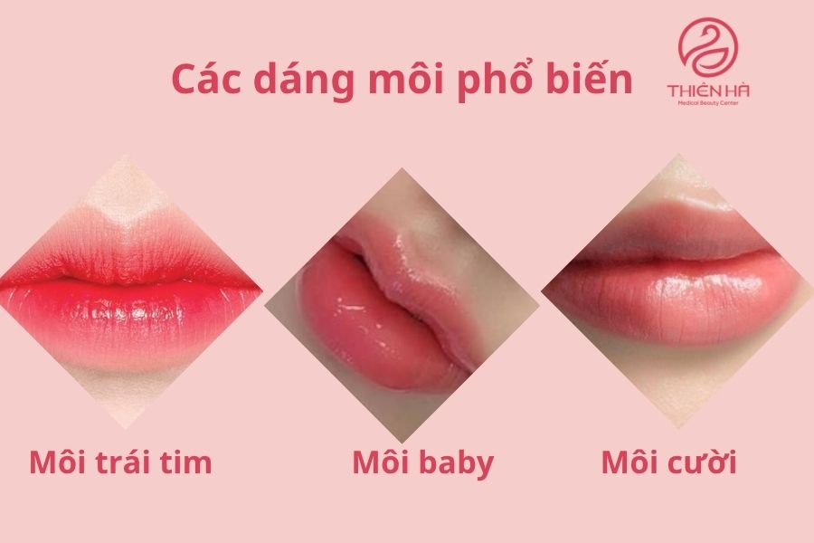 Các dáng môi phổ biến 